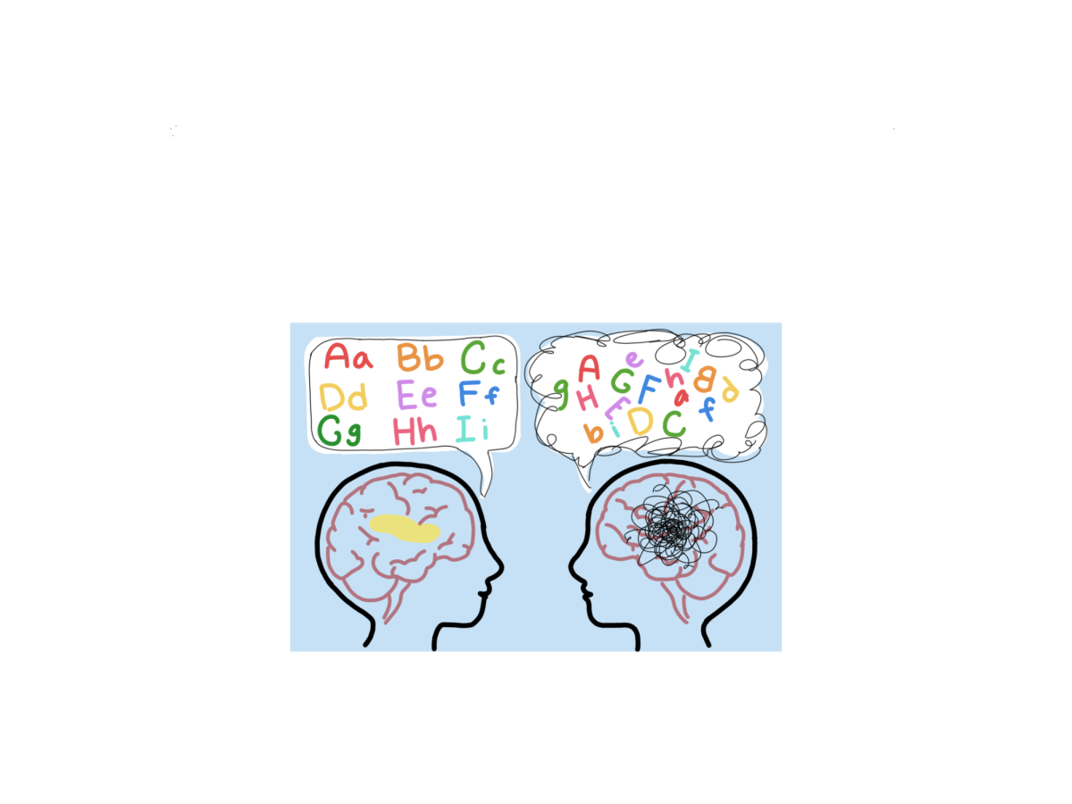Image depicting neurological differences. contrasting a brain without dyslexia and one with it. Graphic by Isadora Truan.